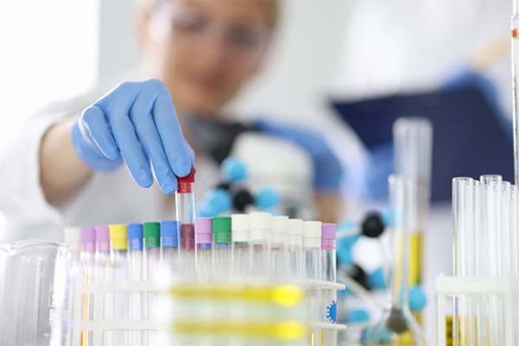 New urine test may help some men with elevated PSA avoid a biopsy